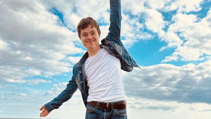 Cetak Sejarah, Pria Ini Terpilih Jadi Bintang Down Syndrome Pertama Disney! Ini Kisahnya