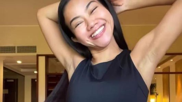 Menginspirasi, 6 Figur Publik Ini Tampil Percaya Diri dengan Kekurangan pada Penampilan Fisiknya!