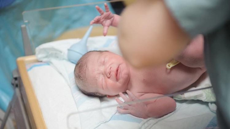 Bayi baru lahir tak menangis