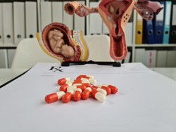 Mahasiswi di Makassar Sempat Minum Pil Aborsi Sebelum Melahirkan di Toilet RS