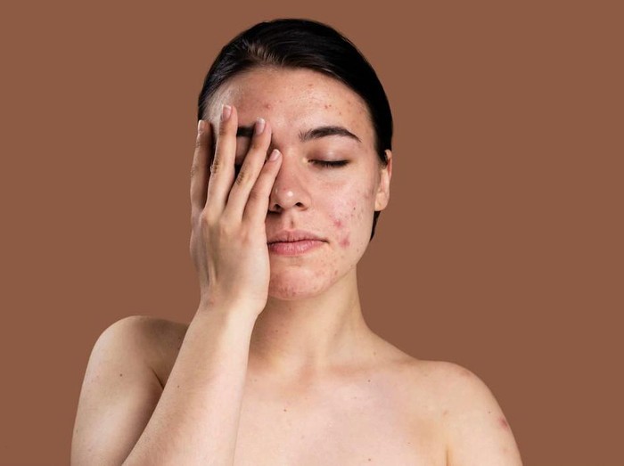 Skinbarrier Rusak / foto: freepik.com/