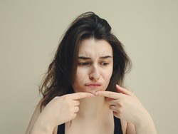 Apakah Acne Patch Efektif Hilangkan Jerawat? Ini Penjelasannya