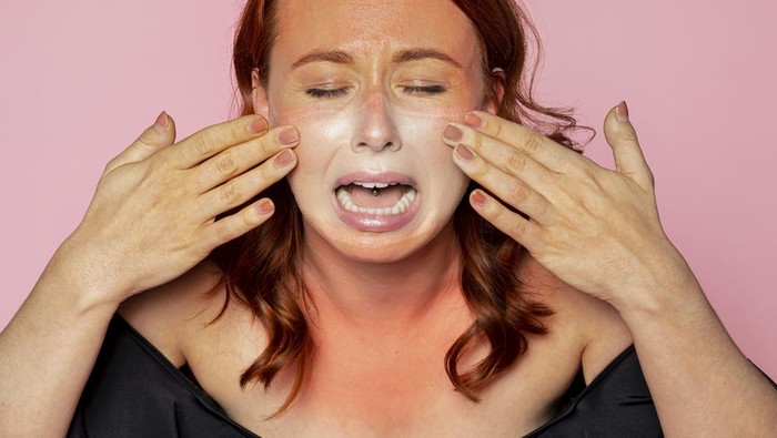 Cara Menghilangkan Belang dan Sunburn Lebih Cepat