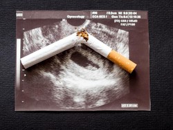 Video: Anak yang Terpapar Asap Rokok 3 Kali Lebih Rentan Masuk IGD