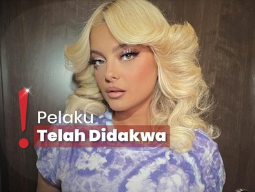 Bebe Rexha Dilempar HP saat Konser, Pelipis Dijahit & Lebam