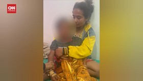 VIDEO: Bocah 8 Tahun Kritis Usai Terinfeksi Rabies