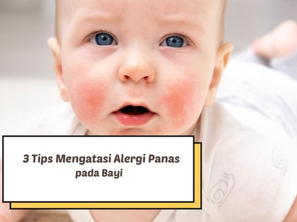 3 Tips Mengatasi Alergi Panas pada Bayi