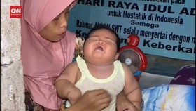 VIDEO: Bayi Obesitas, Usia 7 Bulan Berat 15 Kg Alami Sesak Napas