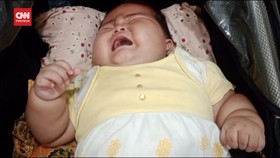 VIDEO: Bayi Obesitas 15 Kg di Bekasi Didiagnosis Alami Gangguan Saraf