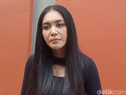 Denada Anggap Operasi Plastik Bentuk Ikhtiar Mencari Nafkah