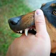 4 Cara Pertolongan Pertama Saat Terkena Gigitan Hewan yang Terinfeksi Rabies