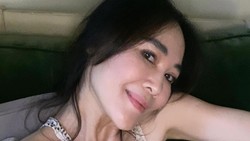 Ina Thomas Pamer Wajah Sebelum dan Sesudah Operasi Plastik di Korea