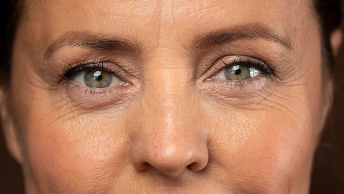 3 Kebiasaan yang Bikin Kulit Wajah Cepat Keriput, Apa Saja?