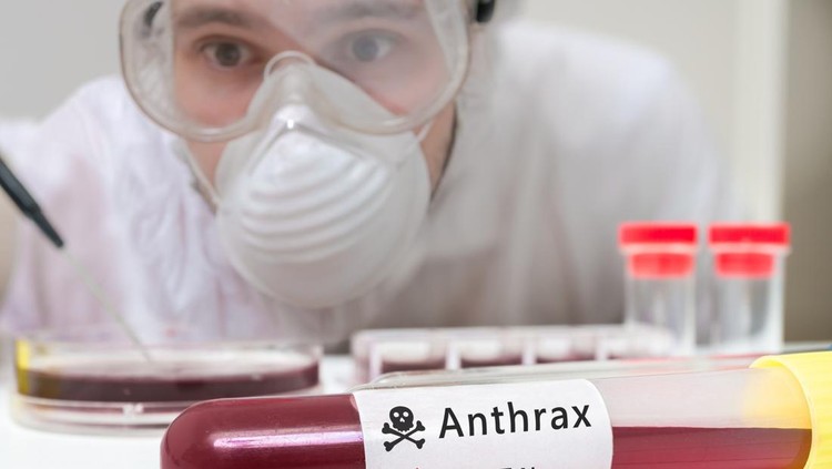 Ilustrasi Antraks Scientist is analyting blood sample for Anthrax.