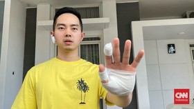 Viral Selebgram Asal Semarang Jadi Korban Percobaan Perampokan 'Ninja'