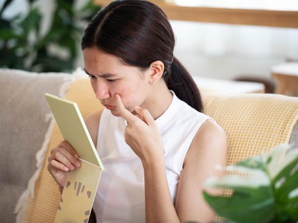 Fakta seputar Anti-Acne Diet, Mengatur Pola Makan Demi Mencegah Jerawat