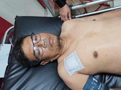 Kronologi Perampokan Bersenpi di Bukittinggi, Pelaku Lepaskan 2 Tembakan