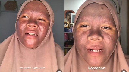 Apakah Liz Skincare Mengandung Merkuri