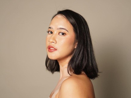 Kisah Dokter Salma Kyana yang Mendadak Alami Vitiligo, Kini Jadi Puteri Indonesia