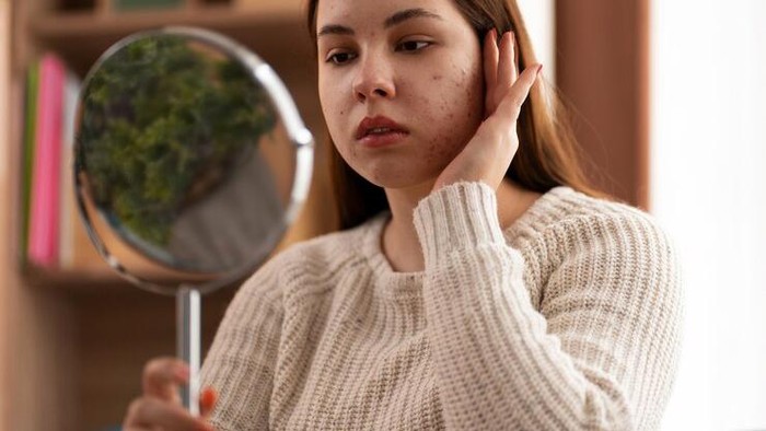 Bikin Wajah Glowing Alami, Ini 5 Daun Penghilang Flek Hitam yang Bisa Dicoba