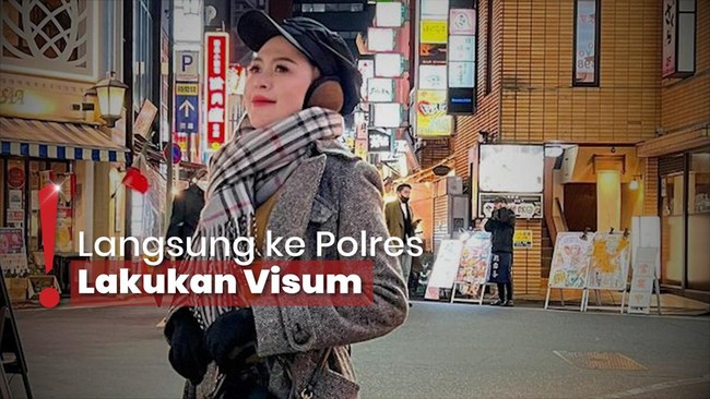 Pergoki Suami Gay, Meylisa Zaara Ngaku Dijambak-Dicakar di Mobil