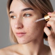 Rekomendasi Skincare untuk Menghilangkan Flek Hitam Bekas Jerawat, Wajah Kembali Mulus dan Cerah