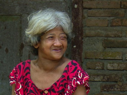 Adik Berbakti, Nyoman Tetap Setia Sendiri Temani Kakak yang Alami Disabilitas