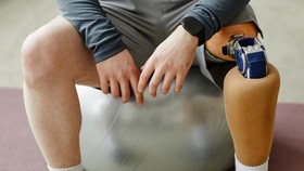 Kaki Siswa SD Bekasi Diamputasi Usai Dijegal & Dibully Teman Sekolah