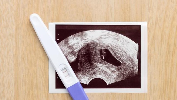 Garis pada hasil test pack bisa menghilang tergantung pada beberapa faktor yang dapat memengaruhinya. Tapi tak perlu langsung khawatir, ketahui penyebabnya yuk.
