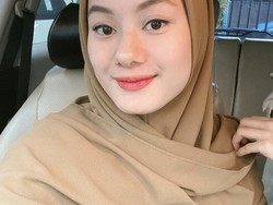 Viral Wajah Dinda Hauw Terkena Kamera Wartawan, Ternyata Begini Aslinya