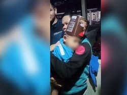 Aksi Petugas Lepas Kaleng Nyangkut di Kepala Anak Tasik