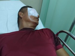 Soal Kasus Wali Murid Ketapel Guru, FSGI Dorong Evaluasi hingga Proses Hukum