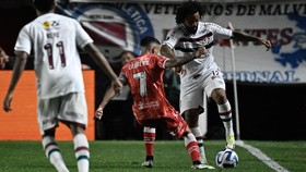 Viral Foto Horor Hasil Pindai Kaki Pemain yang Patah Ditekel Marcelo