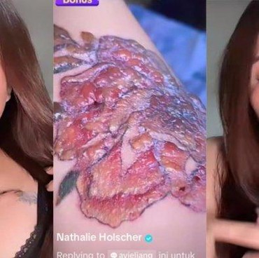 Hapus Tato, Nathalie Holscher Ungkap Bagian Tersakit Saat Dilaser
