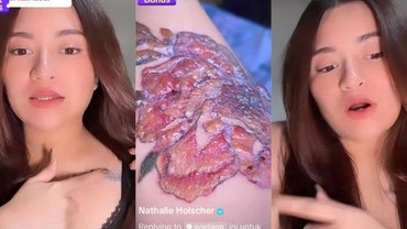 Hapus Tato, Nathalie Holscher Ungkap Bagian Tersakit Saat Dilaser
