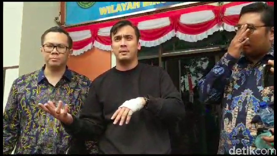 Rawat Lady Usai Kecelakaan, Rendy Kjaernett: Dia yang Paling Penting di Dunia Rawat Lady Usai Kecelakaan, Rendy Kjaernett: Dia yang Paling Penting di Dunia