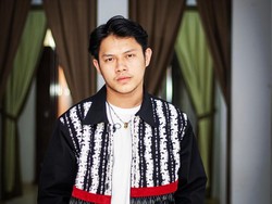 Alami Kerontokan Rambut, Rony Parulian Kini Rajin Perawatan