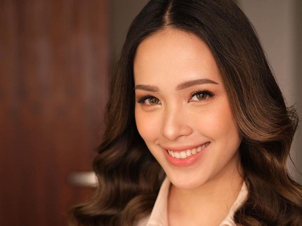 Kondisi Terkini Lady Nayoan Istri Rendy Kjaernett Usai Alami Kecelakaan di Tol