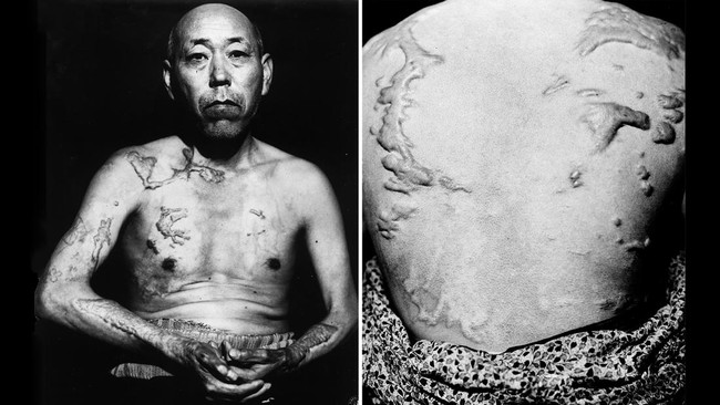 FOTO: Horor Serangan Bom Atom Hiroshima-Nagasaki 78 Tahun Lalu