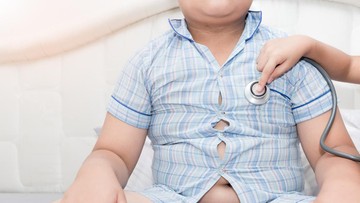 HAL YANG DILAKUKAN SAAT ANAK OBESITAS