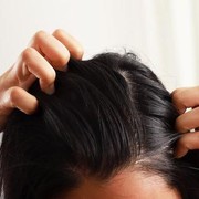 6 Cara Ampuh Hilangkan Kutu Rambut dan Telurnya