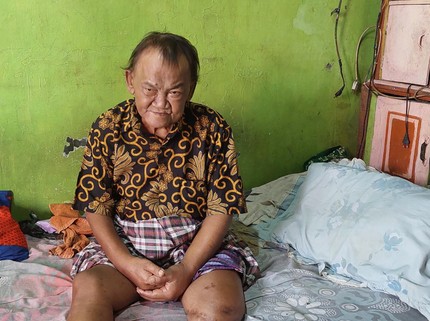 Tangis Sedih Kaki Kakek Penjual Gorengan Hidup Merana Harapkan Kaki Palsu