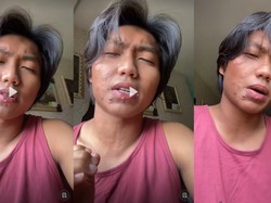 Viral Pria Ngeluh Bintik-bintik Nyaris di Seluruh Wajah, Dituding Kena Sifilis
