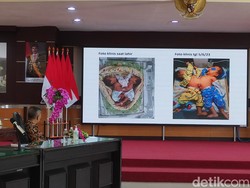 Pertama Kalinya RSSA Malang Akan Operasi Pemisahan Kembar Siam