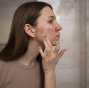 3 Cara Memperbaiki Skin Barrier yang Rusak Akibat Polusi Udara Buruk Menurut Ahli