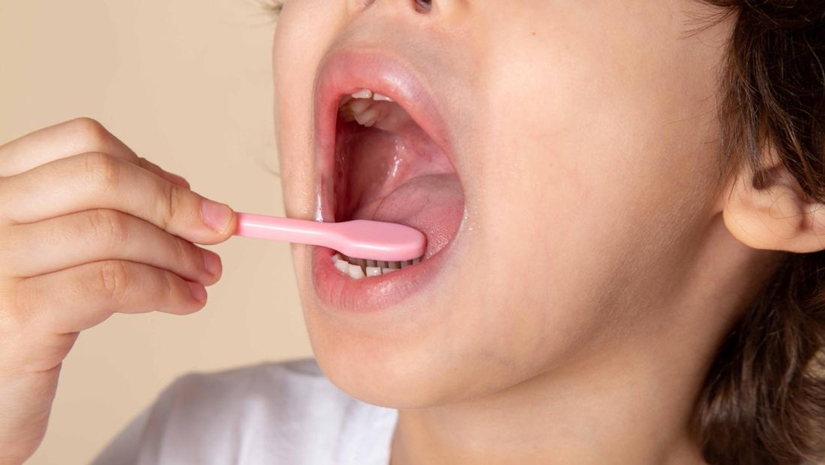 4 dari 10 Anak Sekolah RI Alami Gigi Berlubang
