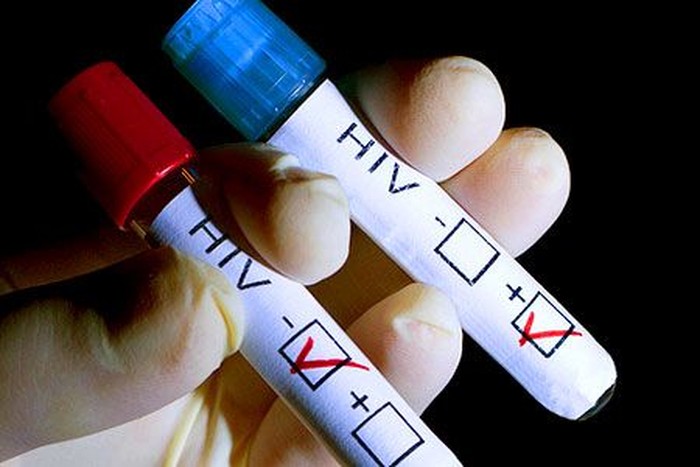 Epidemi hiv aids/Foto: Pinterest/iCare Medical