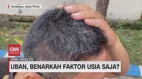 VIDEO: Uban, Benarkah Faktor Usia Saja?