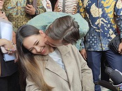 Usai Kecelakaan, Lady Nayoan Luluh Lihat Perubahan Sikap Rendy Kjaernett
