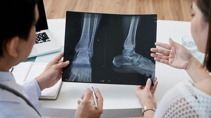 Fakta seputar kesehatan tulang perempuan di usia 40-an